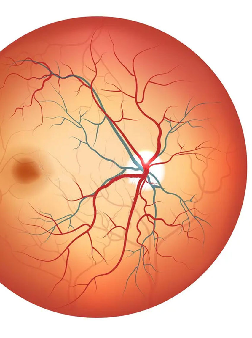 surgery-retina-b