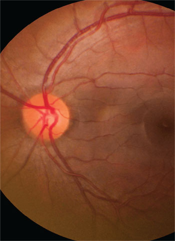 specialty-retina-b